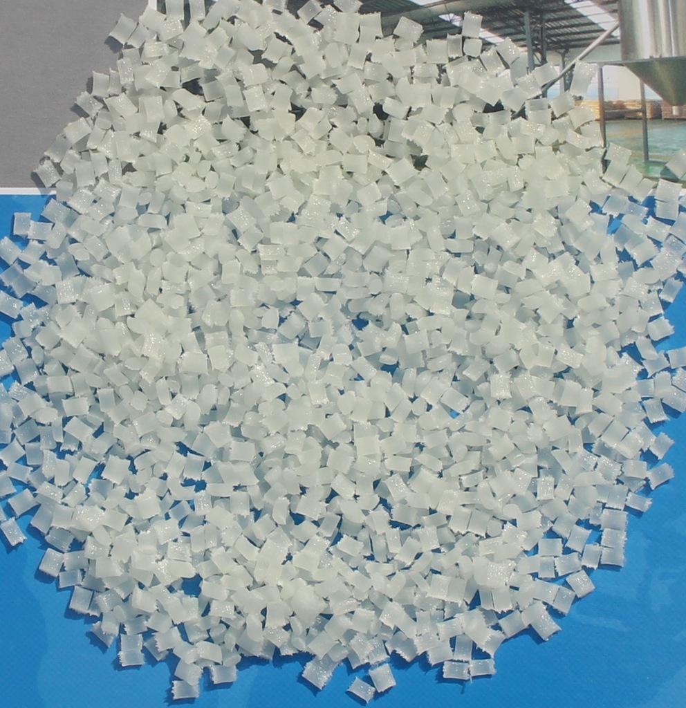 雙能X線骨密度是怎么檢查的?